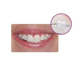 Ligaduras Low Friction Slide Aqua Leone 60 Uds