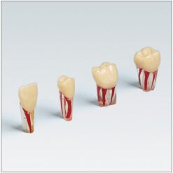 Dientes para Endodoncia con raíz transparente Frasaco AG-3 ZPUK