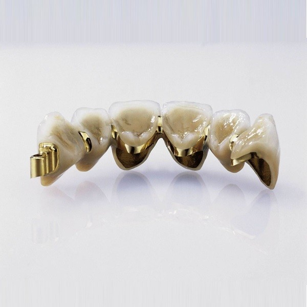 Bonding Metal Composite