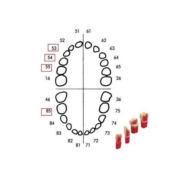 Juego Dientes Temporales + Dientes Pulpotomía Frasaco AK6Z+AK62ZPU