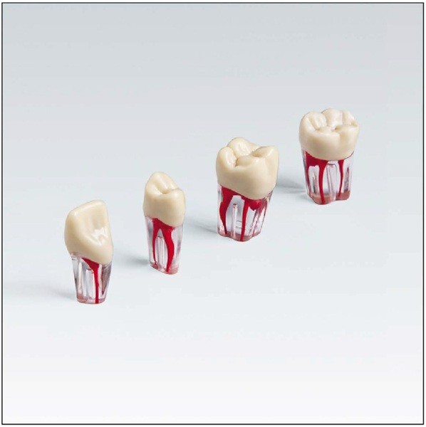 ANA4ZPUK300 Diente endodoncia c/ raíz natural transparente
