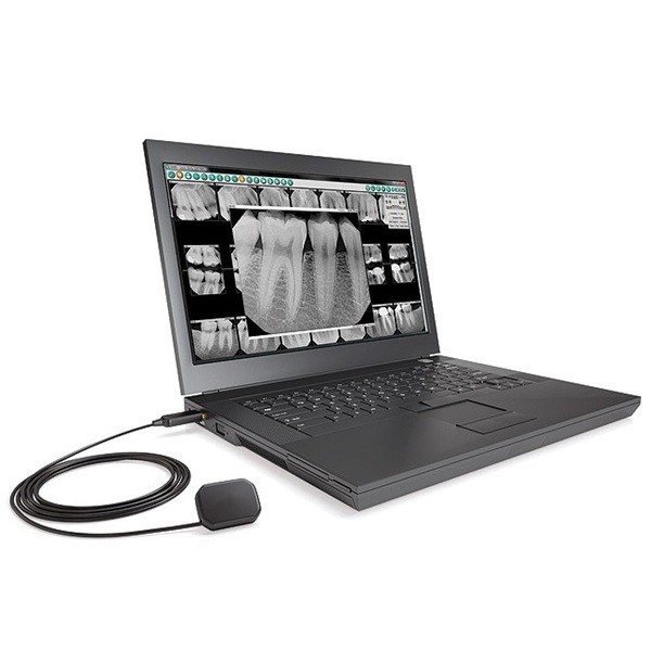 Radiovisiografía - RVG