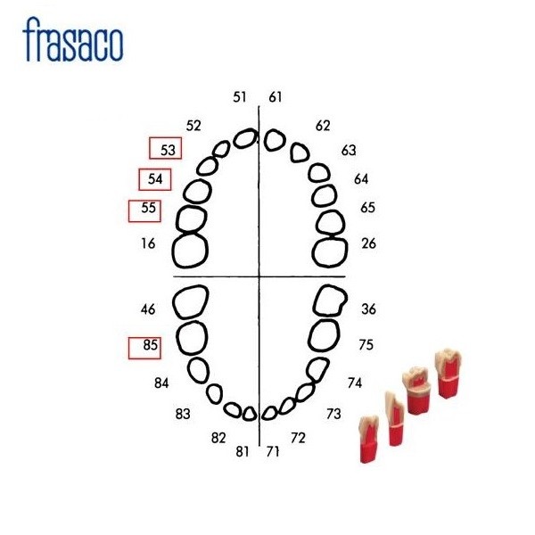 Juego Dientes Temporales + Dientes Pulpotomía Frasaco AK6Z+AK62ZPU