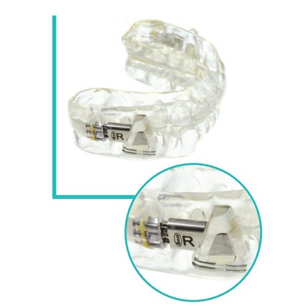 Twin Wing Kit Corrector para Clase II