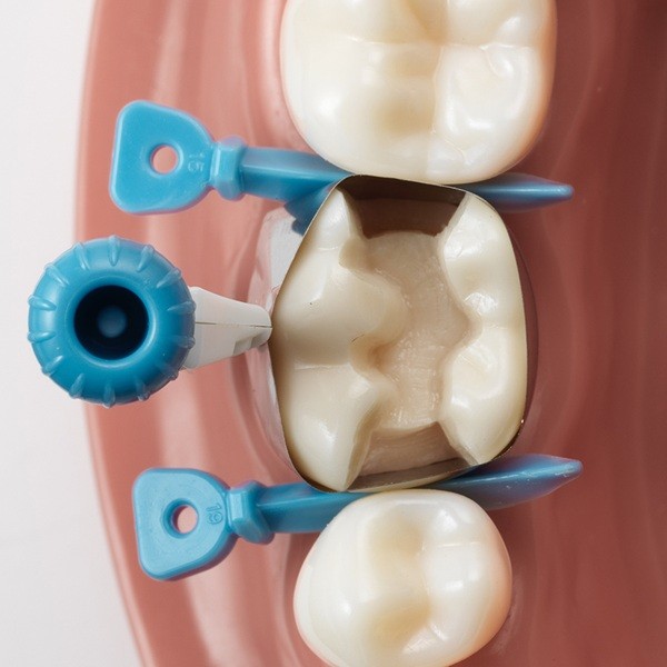 Palodent 360 48 Uds - Imagen 4