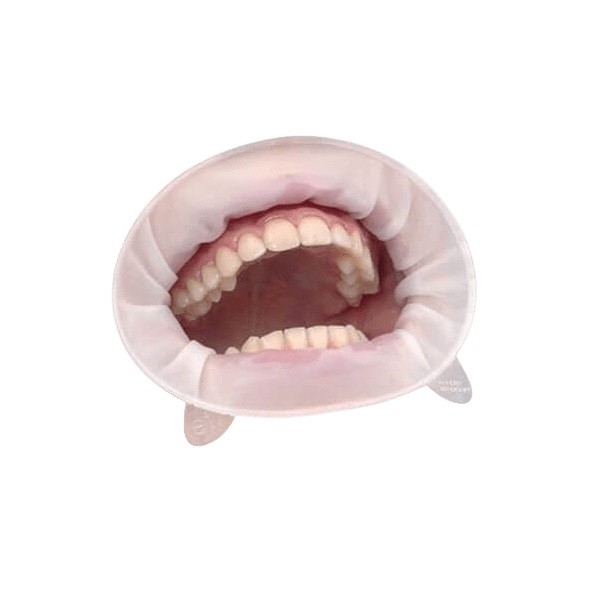 Optragate Surtido 40 uds regular + 40 uds small