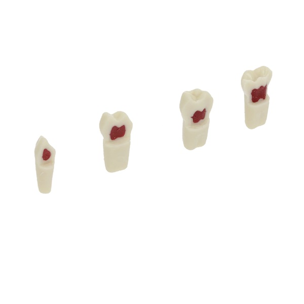 Kit 4 Dientes Pulpotomía Frasaco AK-6/2 ZPUW