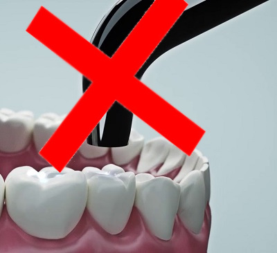 Composites Autopolimerizables