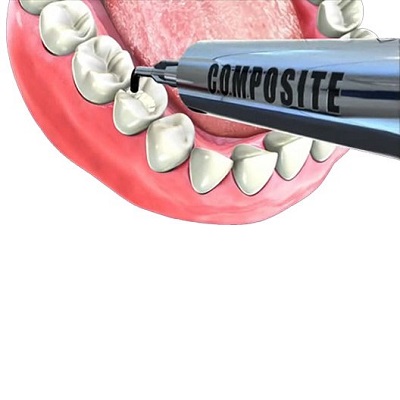 Composites Universales