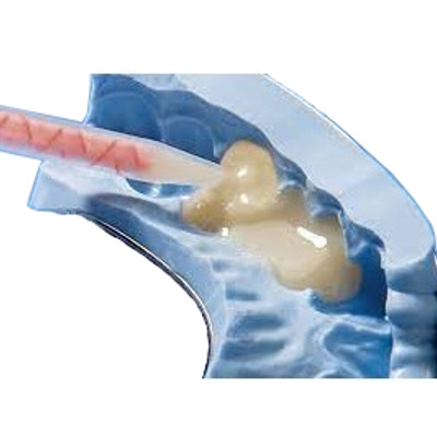 Resinas para provisionales Automezcla